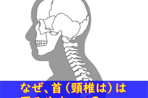 なぜ、首(頸椎）は歪みやすい？