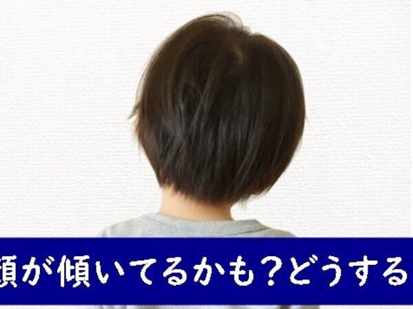 顔が傾いてるかも「どうしたらいい」