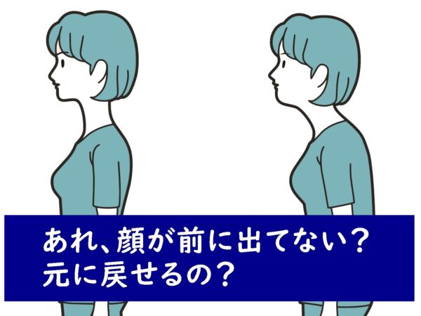 顔が前に出ているかも・・なんとかなる？