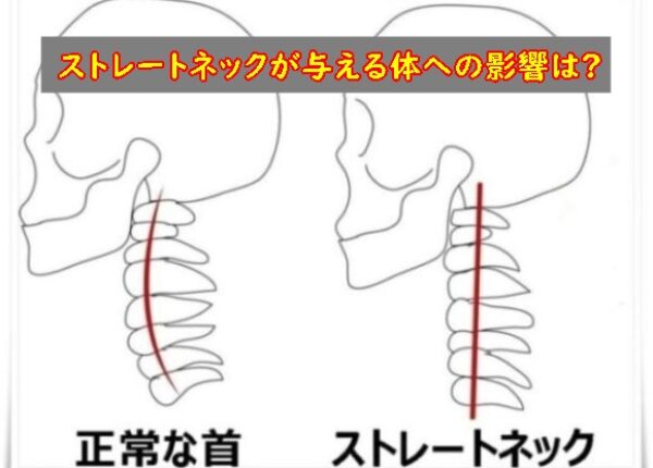ストレートネックは体にどんな影響がある？